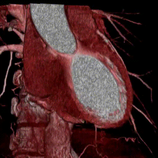 心臓とその周囲の血管を立体的に再構成した 3D 画像