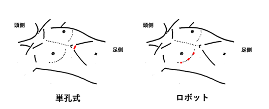 創部の位置と大きさ